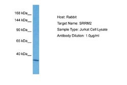 SRRM2 Rabbit anti-Human, Polyclonal, Novus Biologicals 0.1ml; Unconjugated:Antibodies,